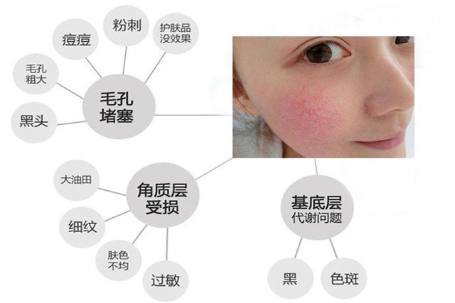 你一直误会了角质层？化妆品代加工厂家揭秘90%的人不知道的真相